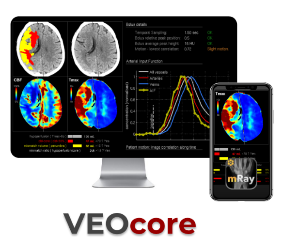 Logo von VEObrain